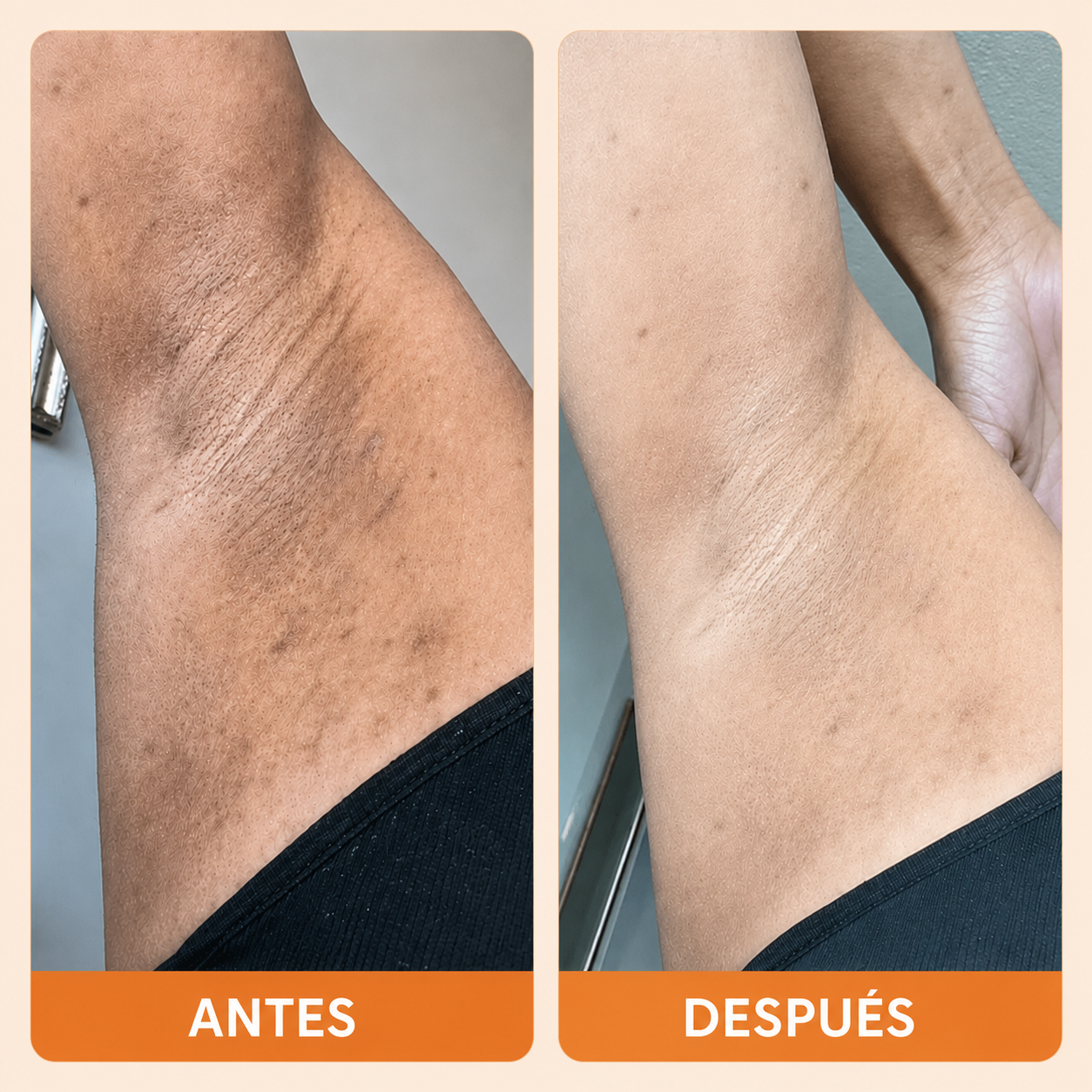 Velmara® | Spray exfoliante iluminador
